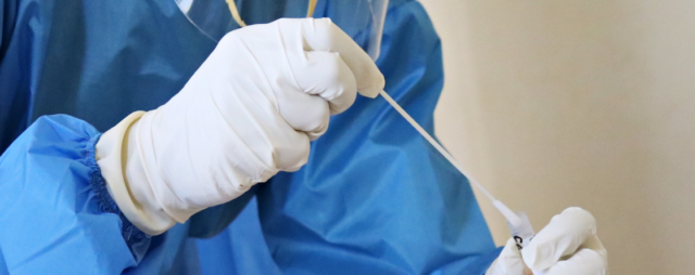 L'immagine attuale non ha un testo alternativo. Il nome del file è: tampone-salivare.png